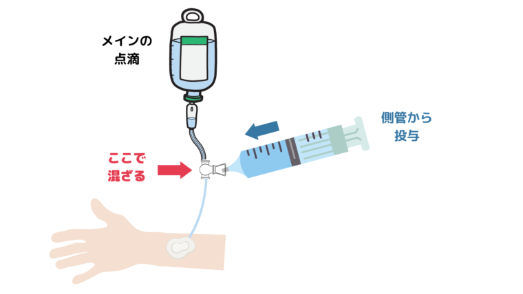 配合変化